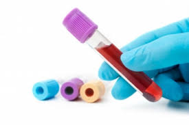 Analyses médicales